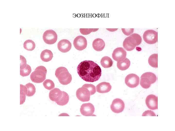 ЭОЗИНОФИЛ 