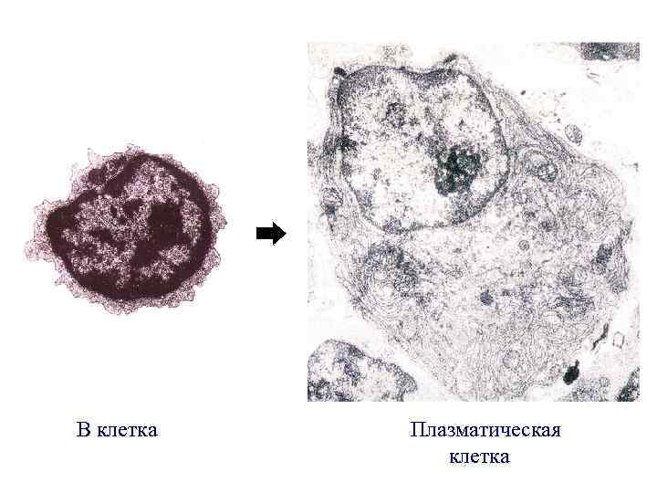 В клетка Плазматическая клетка 