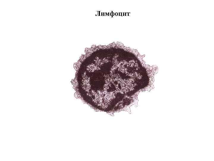 Лимфоцит 