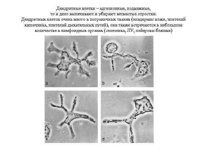 Дендритные клетки – адгезионные, подвижные, то и дело выпячивают и убирают ветвистые отростки. Дендритных