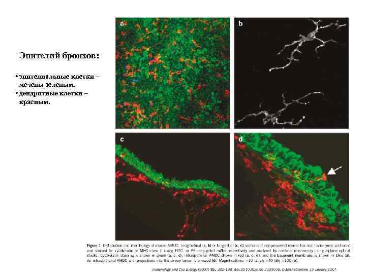 Эпителий бронхов: • эпителиальные клетки – мечены зеленым, • дендритные клетки – красным. 