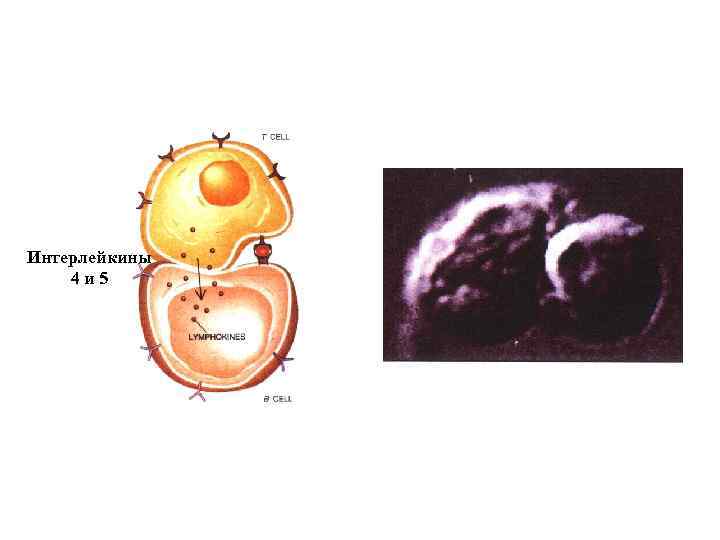 Интерлейкины 4 и 5 