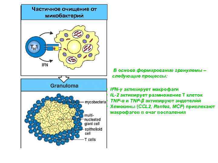 Частичное очищение от микобактерий В основе формирования гранулемы – следующие процессы: • • IFN-γ