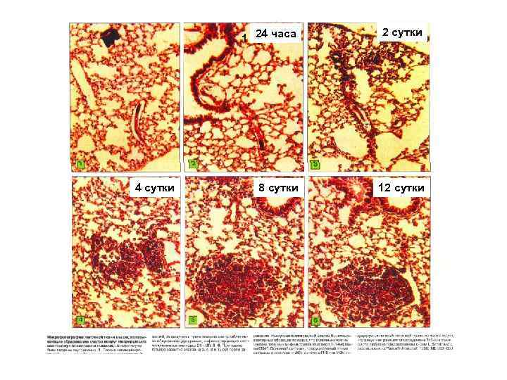 24 часа 1 сутки 4 сутки 2 сутки 8 сутки 12 сутки 