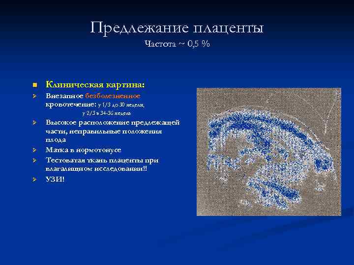 Предлежание плаценты Частота ~ 0, 5 % n Клиническая картина: Ø Внезапное безболезненное кровотечение: