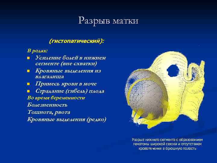 Разрыв матки (гистопатический): В родах: n n Усиление болей в нижнем сегменте (вне схватки)