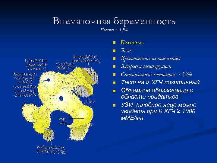 Внематочная беременность Частота ~ 1, 5% n n n n Клиника: Боль Кровотечение из