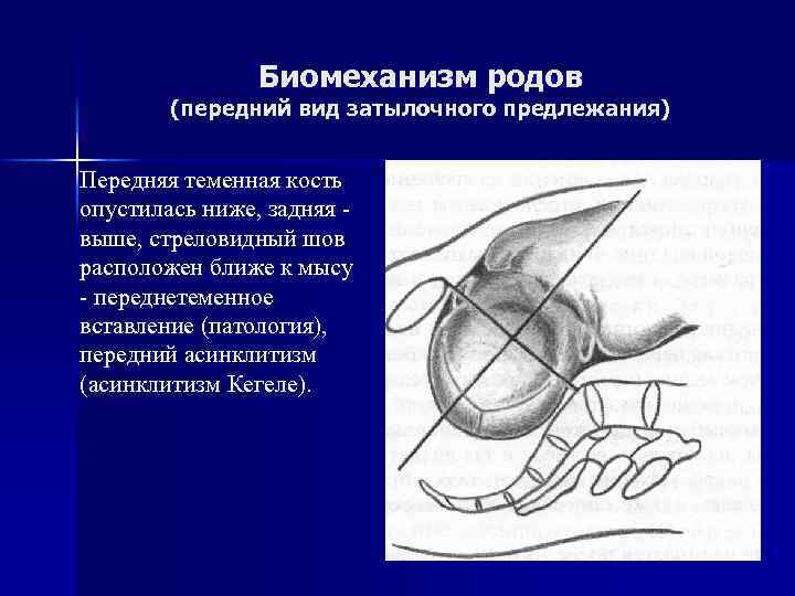 Биомеханизм родов при переднем виде затылочного предлежания презентация