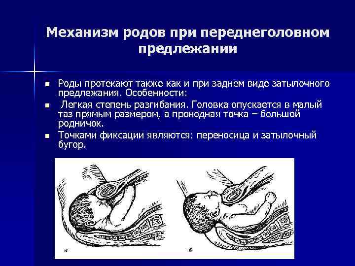 Механизм родов при переднеголовном предлежании n n n Роды протекают также как и при