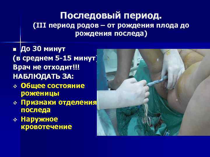 Последовый период. (III период родов – от рождения плода до рождения последа) До 30