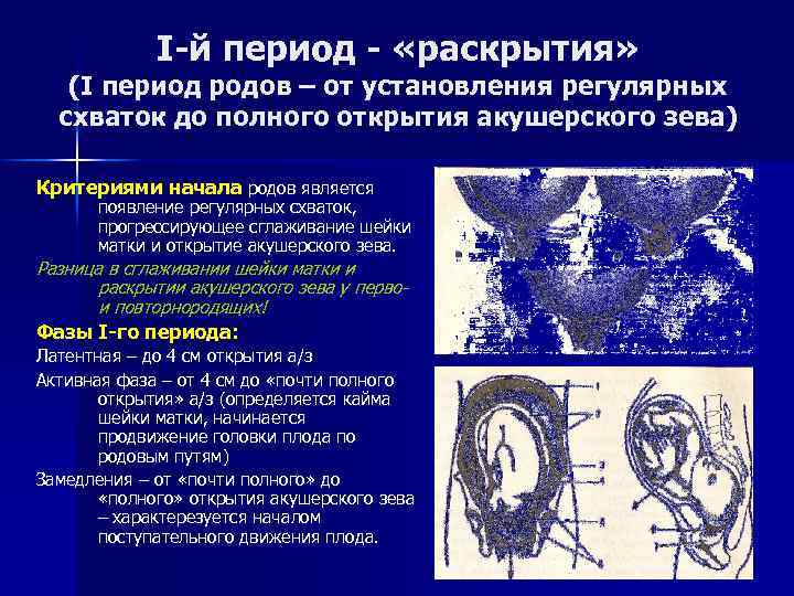 Й период. Периоды родов раскрытие. Периоды родов раскрытие зева. Фазы периода раскрытия. Вторая фаза периода раскрытия.