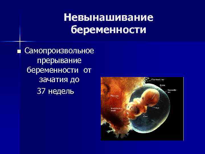 Невынашивание беременности n Самопроизвольное прерывание беременности от зачатия до 37 недель 