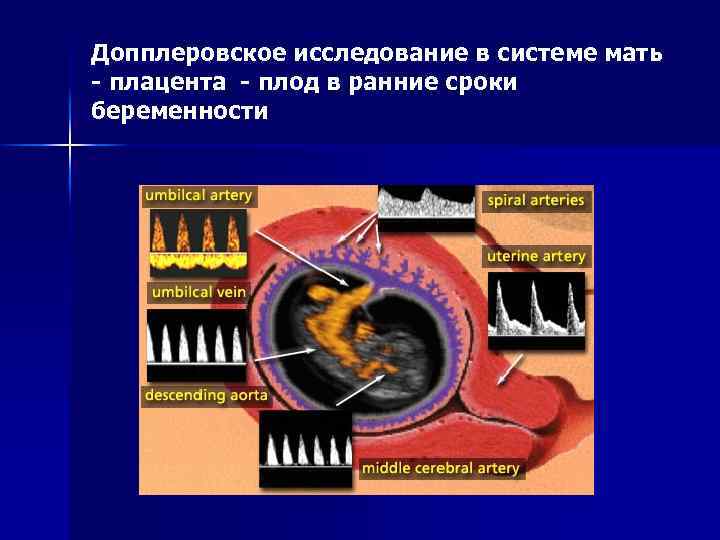 Допплеровское исследование в системе мать - плацента - плод в ранние сроки беременности 