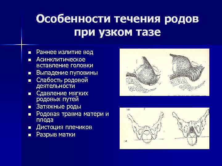 План ведения родов при узком тазе