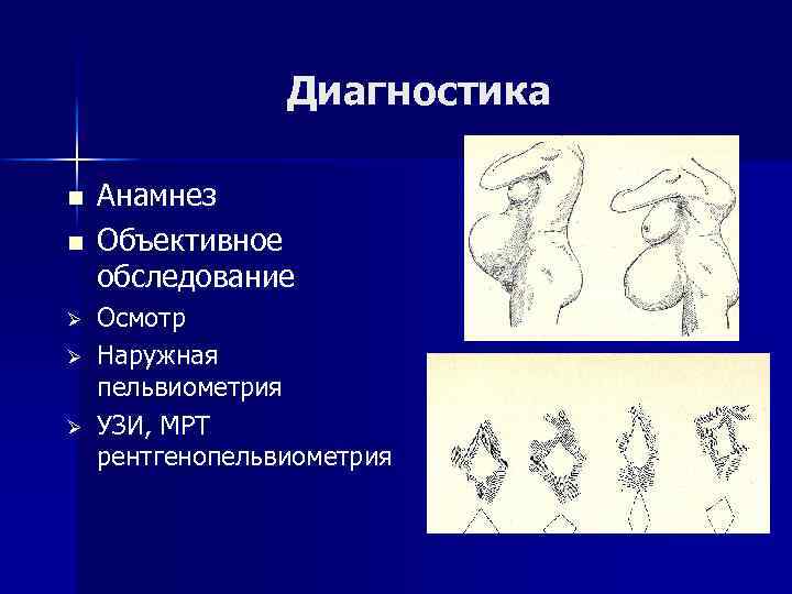 Диагностика n n Ø Ø Ø Анамнез Объективное обследование Осмотр Наружная пельвиометрия УЗИ, МРТ