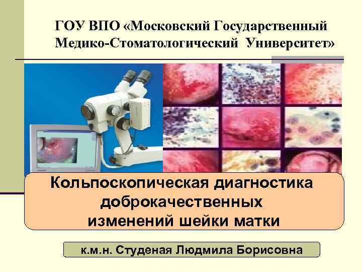 ГОУ ВПО «Московский Государственный Медико-Стоматологический Университет» Кольпоскопическая диагностика доброкачественных изменений шейки матки к. м.