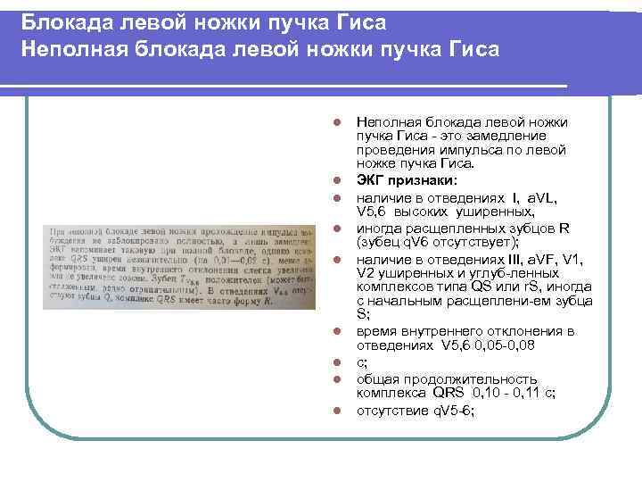 Блокада левой ножки пучка Гиса Неполная блокада левой ножки пучка Гиса l l l