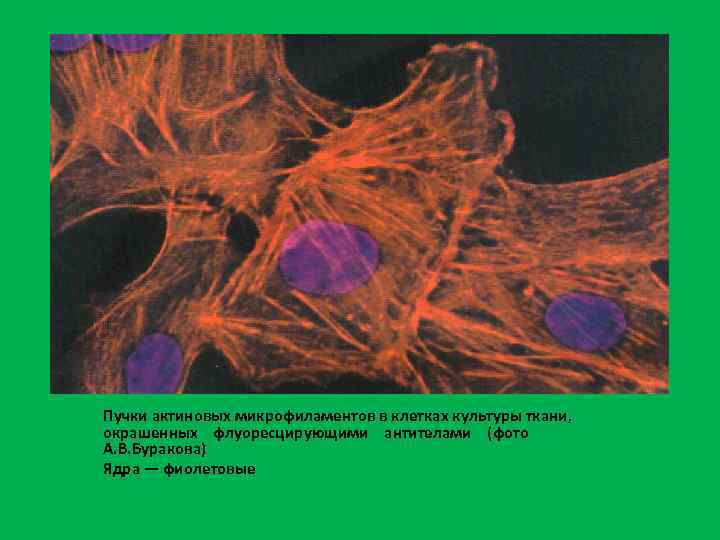 Пучки актиновых микрофиламентов в клетках культуры ткани, окрашенных флуоресцирующими антителами (фото А. В. Буракова)