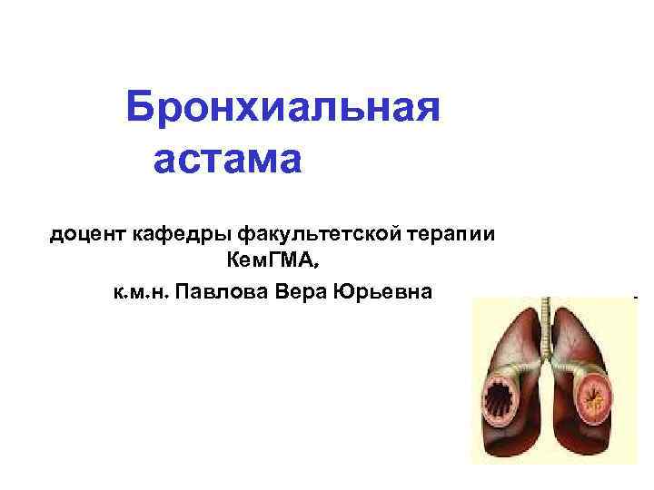 Бронхиальная астама доцент кафедры факультетской терапии Кем. ГМА, к. м. н. Павлова Вера Юрьевна