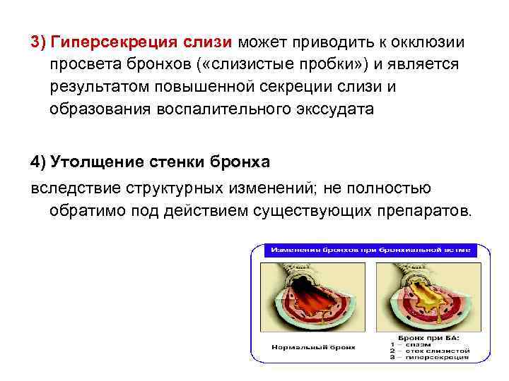 3) Гиперсекреция слизи может приводить к окклюзии просвета бронхов ( «слизистые пробки» ) и
