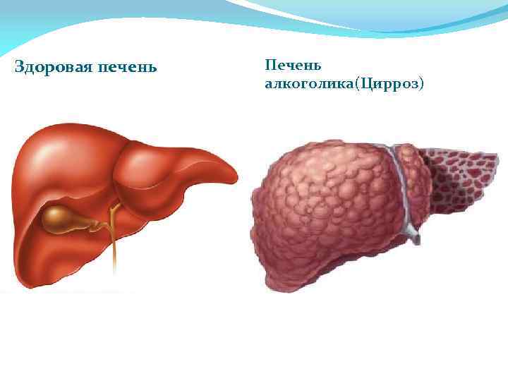 Алкоголь и печень картинки