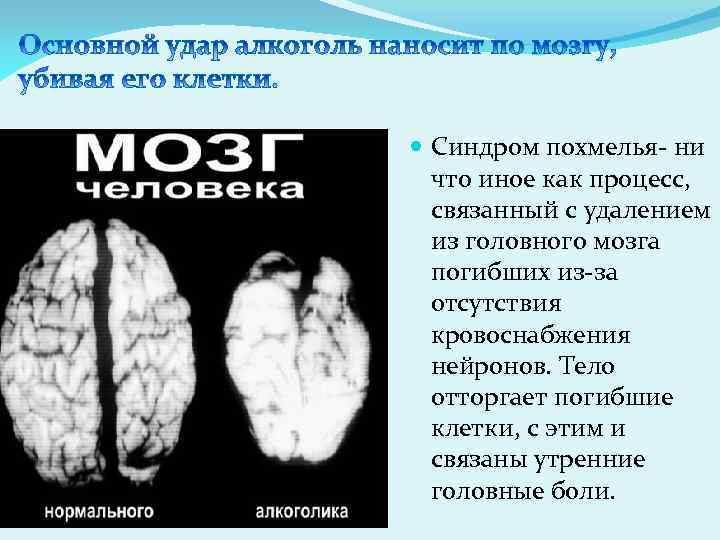  Синдром похмелья- ни что иное как процесс, связанный с удалением из головного мозга