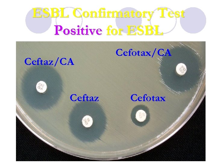 ESBL Confirmatory Test Positive for ESBL Ceftaz/CA Ceftaz Cefotax/CA Cefotax 