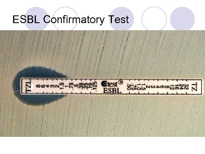 ESBL Confirmatory Test 