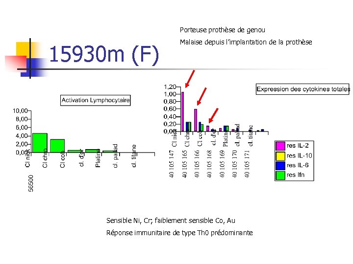 Porteuse prothèse de genou 15930 m (F) Malaise depuis l’implantation de la prothèse Sensible