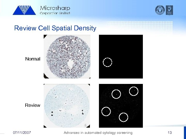 Review Cell Spatial Density Normal Review 07/11/2007 Advances in automated cytology screening 13 