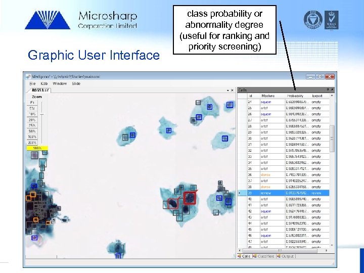 Graphic User Interface 07/11/2007 class probability or abnormality degree (useful for ranking and priority