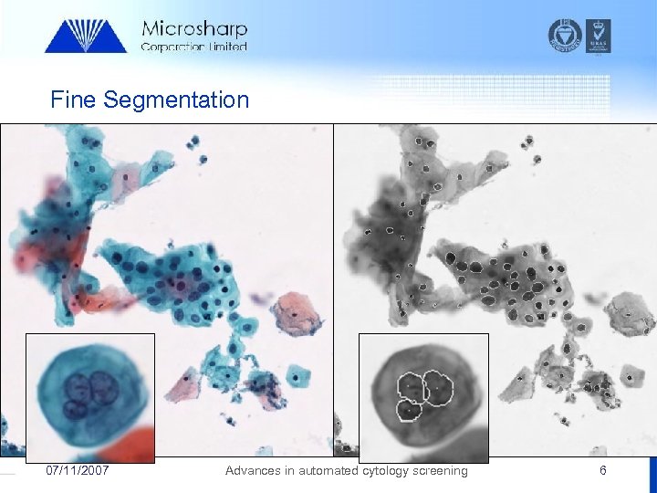 Fine Segmentation 07/11/2007 Advances in automated cytology screening 6 