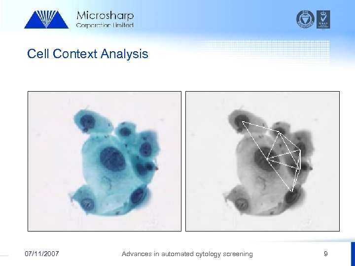 Cell Context Analysis 07/11/2007 Advances in automated cytology screening 9 