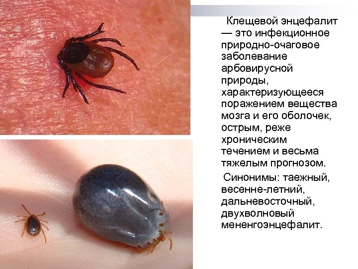 Клещевой энцефалит — это инфекционное природно-очаговое заболевание арбовирусной природы, характеризующееся поражением вещества мозга и