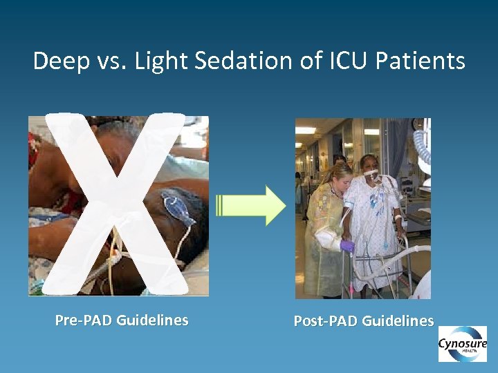 X Deep vs. Light Sedation of ICU Patients Pre-PAD Guidelines Post-PAD Guidelines 