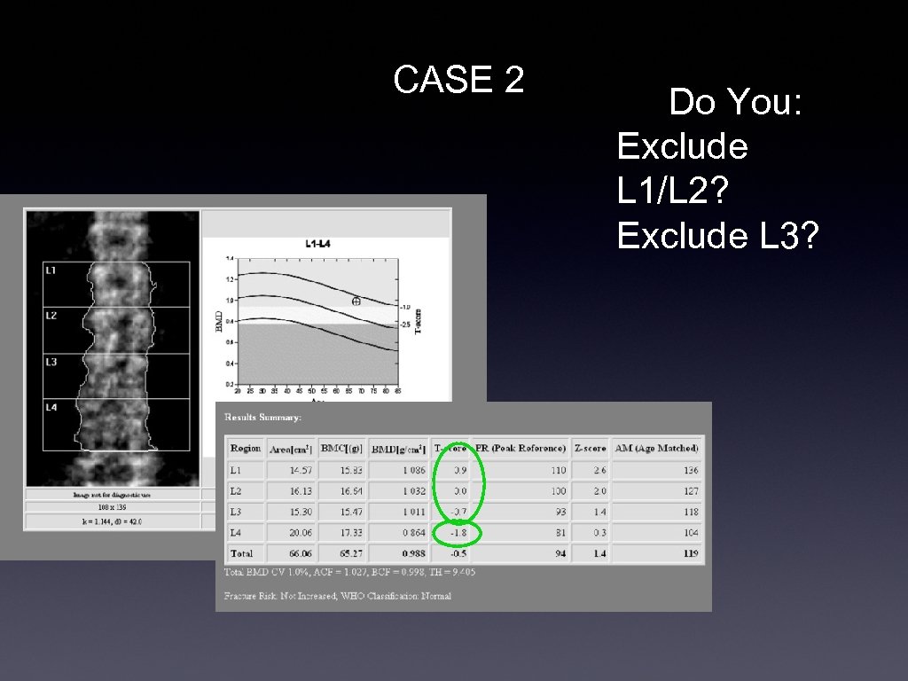 CASE 2 Do You: Exclude L 1/L 2? Exclude L 3? 