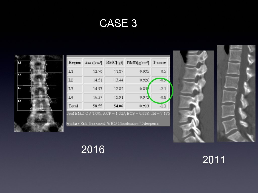 CASE 3 2016 2011 