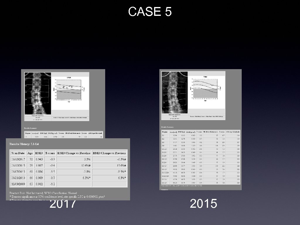 CASE 5 2017 2015 