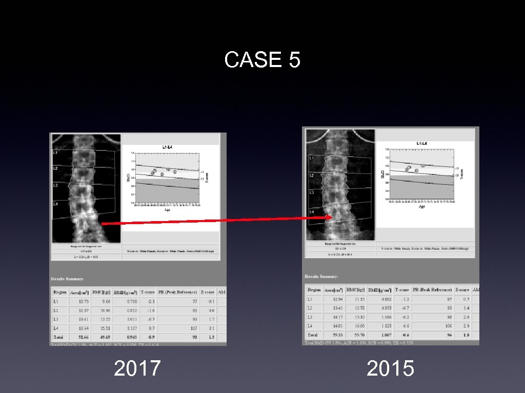 CASE 5 2017 2015 