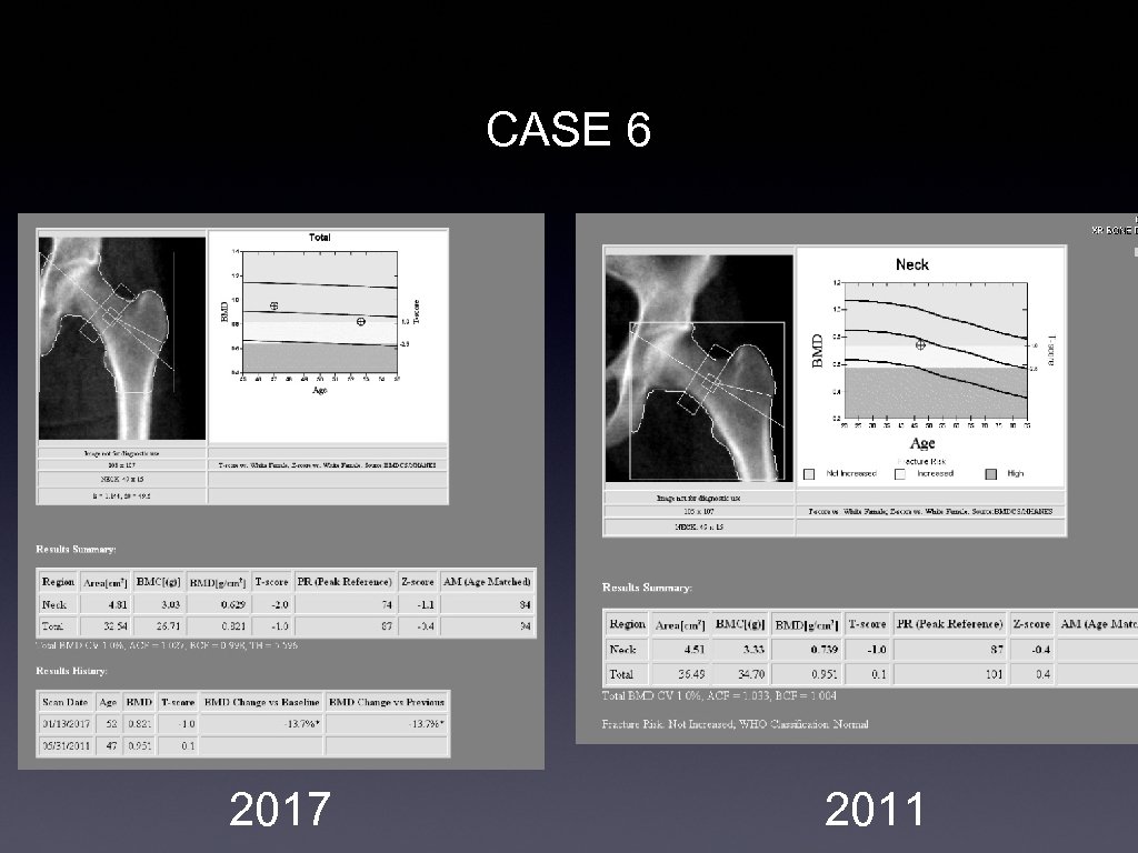 CASE 6 2017 2011 