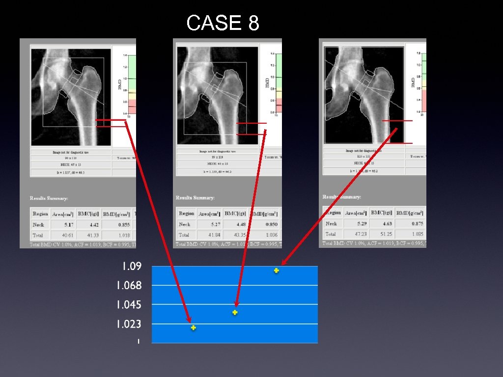 CASE 8 