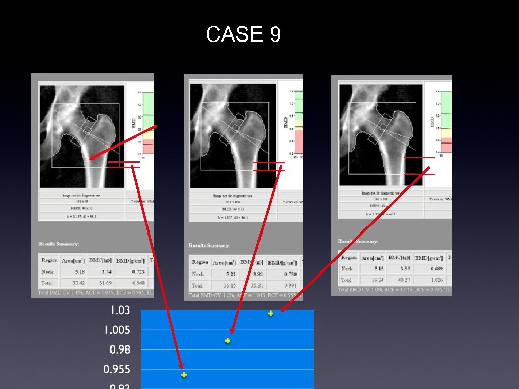 CASE 9 