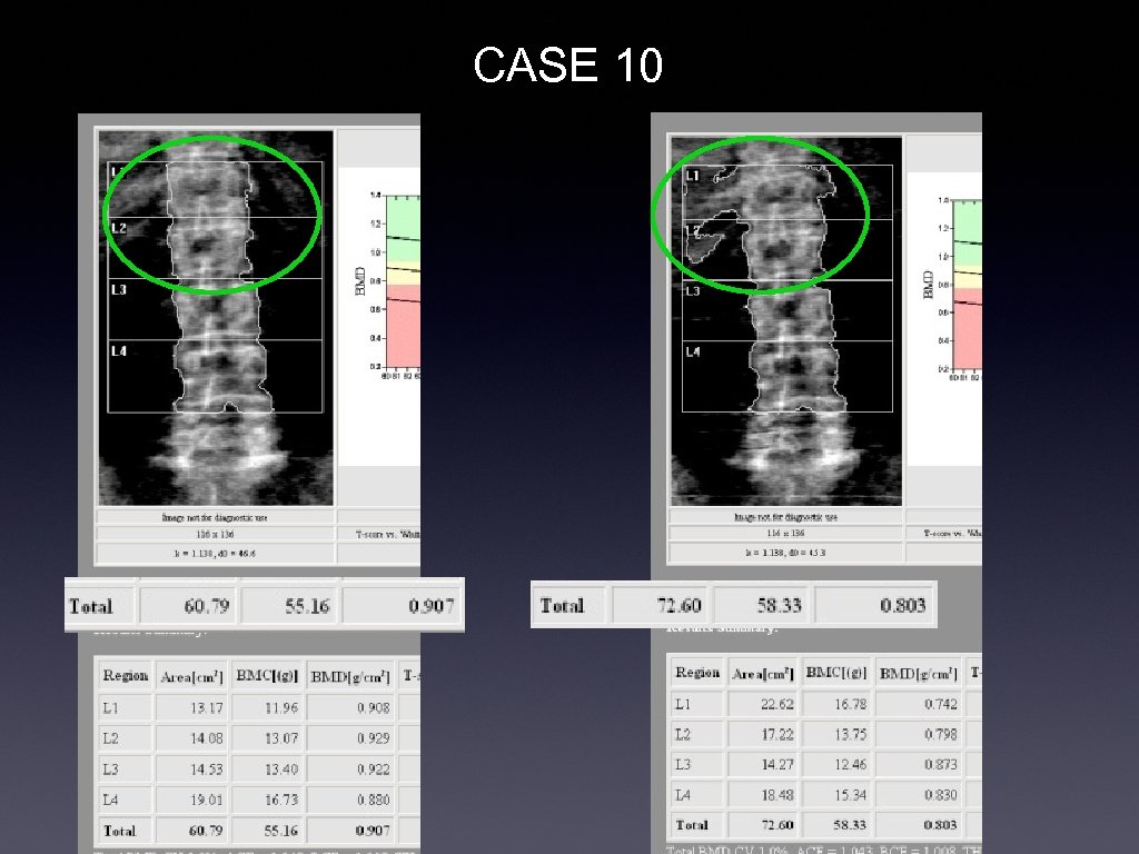 CASE 10 