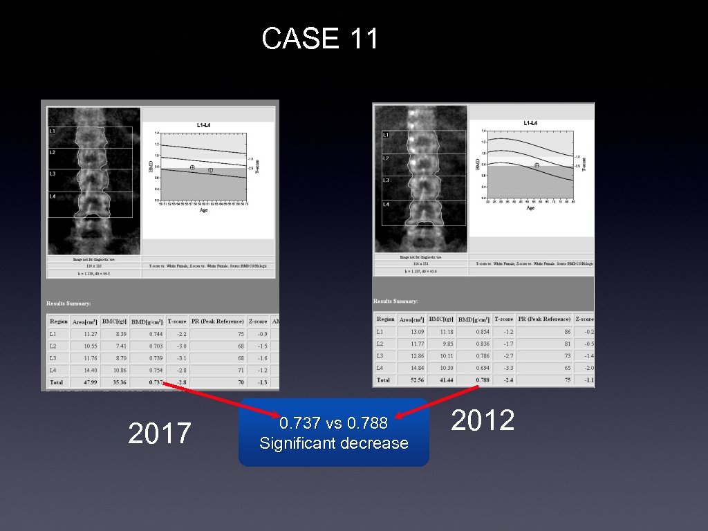 CASE 11 2017 0. 737 vs 0. 788 Significant decrease 2012 