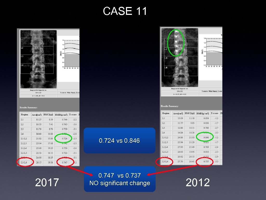 CASE 11 0. 724 vs 0. 846 2017 0. 747 vs 0. 737 NO