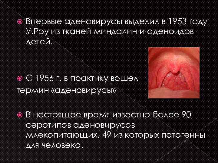  Впервые аденовирусы выделил в 1953 году У. Роу из тканей миндалин и аденоидов