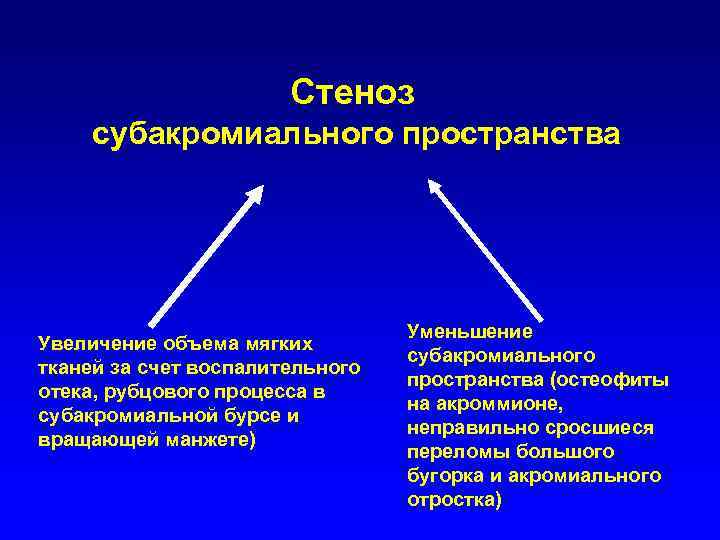Стеноз субакромиального пространства Увеличение объема мягких тканей за счет воспалительного отека, рубцового процесса в