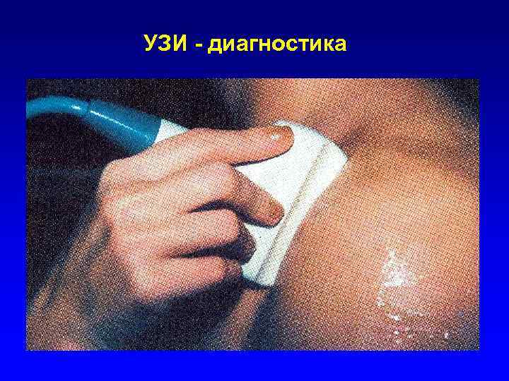 УЗИ - диагностика 