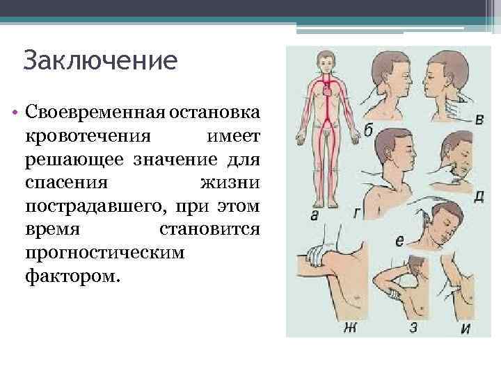 Заключение • Своевременная остановка кровотечения имеет решающее значение для спасения жизни пострадавшего, при этом