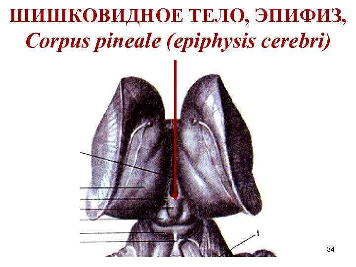 ШИШКОВИДНОЕ ТЕЛО, ЭПИФИЗ, Corpus pineale (epiphysis cerebri) 34 